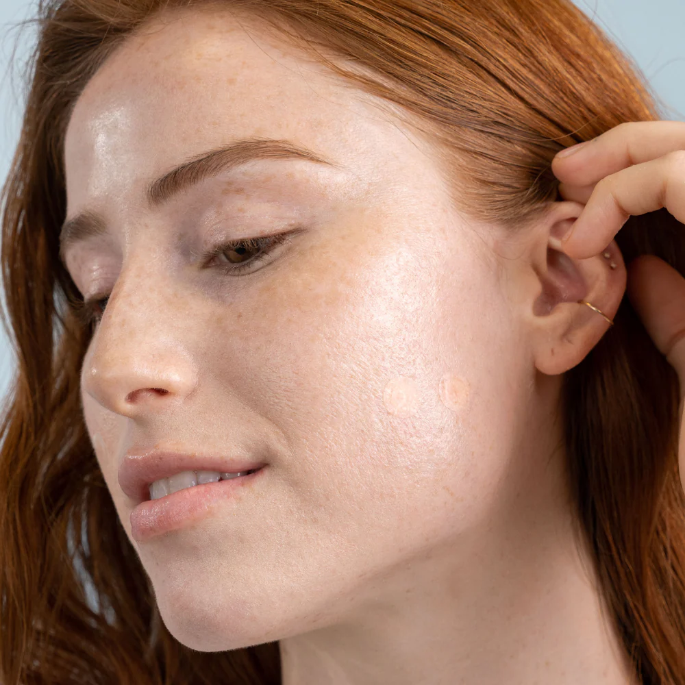 DermaDot Invisible Pimple Patches - Image 3